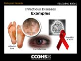 Infectious Diseases - Examples